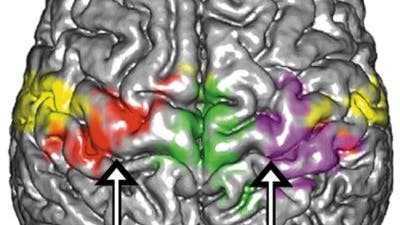 Magnetresonanz- spektroskopische Aufnahme eines Gehirns