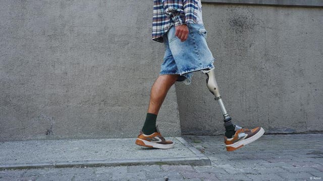 Günstigere Prothesen dank 3D-Druck