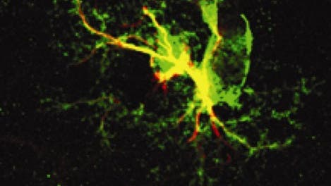 Radialgliazellen bilden neuronale Stammzellen