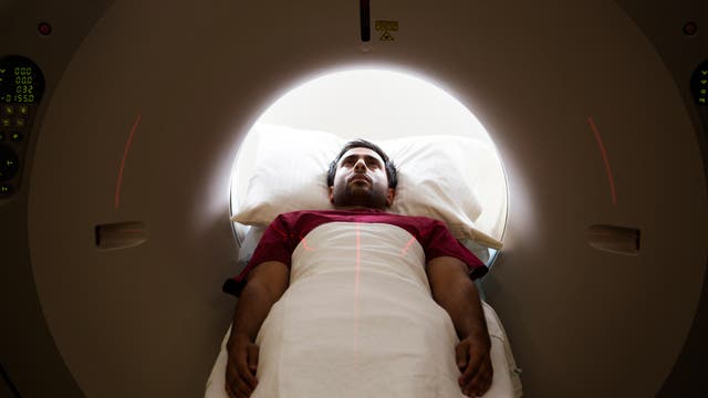 Eine Person liegt auf dem Rücken mit dem Kopf in einem MRT-Scanner. Rote Laserlinien sind auf dem Körper sichtbar, die zur Positionierung während des Scans dienen. Der Körper ist mit einem weißen Laken bedeckt, die Arme ruhen auf dem Laken.