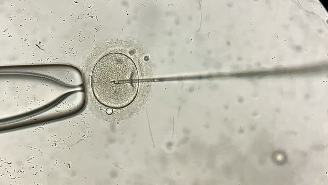 Ein Mikroskopbild zeigt eine In-vitro-Fertilisation (IVF), bei der eine feine Nadel in eine menschliche Eizelle eingeführt wird.
