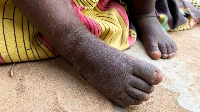 Die unbekleideten Füße eines kleines Mädchens dunklerer Hautfarbe im Sand.