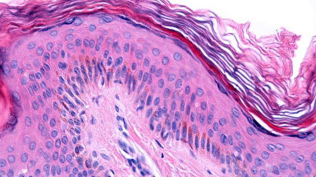 Mikroskopische Aufnahme von menschlichem Hautgewebe, gefärbt mit Hämatoxylin und Eosin. Die Schichten der Epidermis sind deutlich sichtbar, mit dicht gepackten Zellen und klar erkennbaren Zellkernen in verschiedenen Schattierungen von Rosa und Lila. Die oberste Schicht zeigt eine wellenförmige Struktur, die die Hornschicht darstellt. Darunter sind die Basalschicht und die darunter liegende Dermis zu sehen, die eine faserige Textur aufweist.