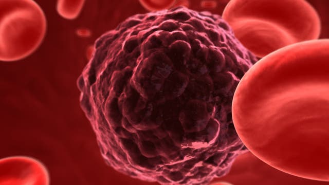 Nanomagneten im Kampf gegen Krebs
