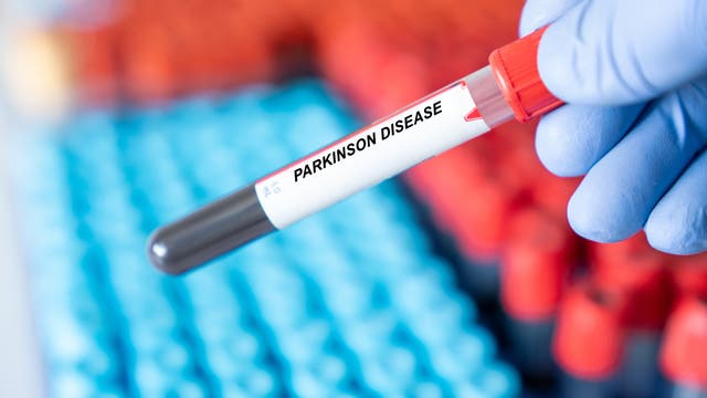 Röhrchen mit einer Blutprobe, die mit »Parkinson Disease« beschriftet ist