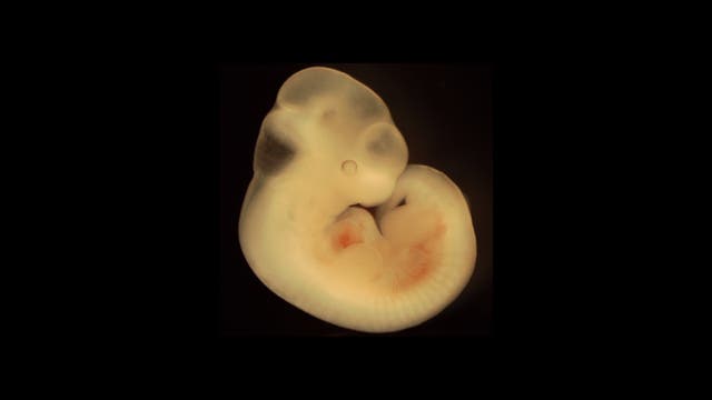 Embryo der Maus am 11. Tag.