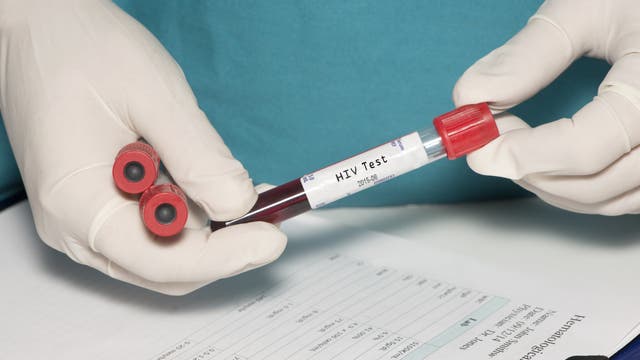 Zwei Hände in Handschuhen spielen mit mehrere Ampullen voll Blut herum. Auf einer davon steht "HIV-Test". Mit echten HIV-verdächtigen Blutproben geht man allerdings etwas weniger lässig um.