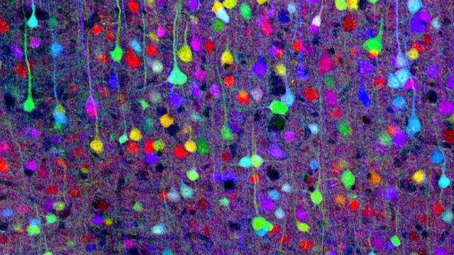 Neurone live und in Farbe