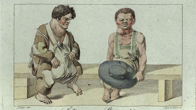 Männer mit Kröpfen aus der Steiermark. Zeichnung von 1819.