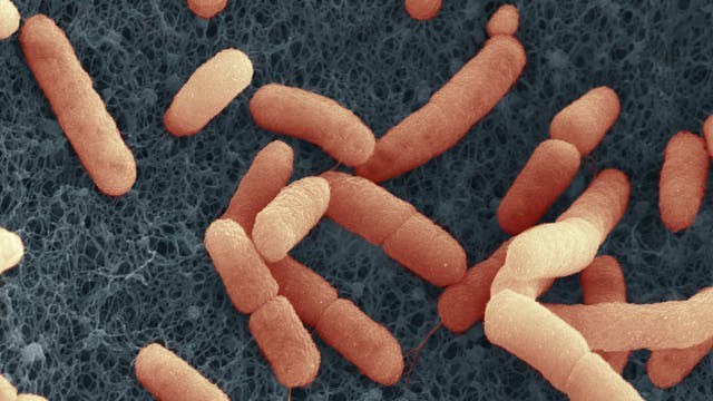 Elektronenmikroskopische Aufnahme von stäbchenförmigen Bakterien auf einer strukturierten Oberfläche. Die Bakterien sind in einer orangefarbenen Färbung dargestellt, während der Hintergrund dunkelgrau ist. Die Aufnahme zeigt die detaillierte Textur der Bakterien und der Oberfläche. Ein Maßstabsbalken ist am unteren Rand sichtbar.
