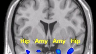 Hippokampus und Amygdala