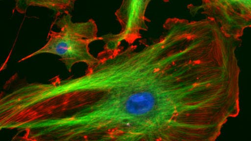 Endothelzelle mit Fluoreszenzmarkiertem Zellskelett