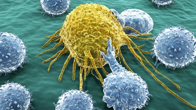 Menschliche T-Lymphozyten (blau) attackieren eine Krebszelle (gelb). Kolorierte Raster-Elektronen-Mikroskopische Aufnahme.