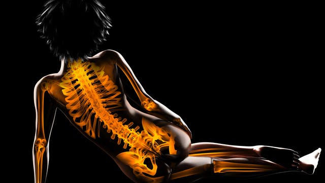 Knochen - Rückenansicht einer Frau
