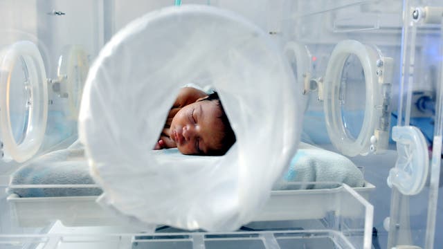 Die Behandlung von Frühgeborenen hat sich in den vergangenen Jahrzehnten verbessert, aber die Überlebensraten variieren je nach Alter und Land.