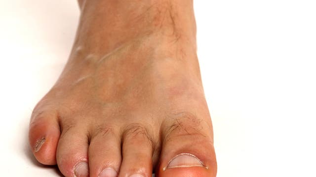 Menschlicher Fuß