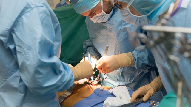 Chirurgisches Team in einem Operationssaal, das konzentriert an einem Patienten arbeitet. Die Ärzte tragen blaue OP-Kleidung, Masken und Handschuhe. Sie verwenden chirurgische Instrumente unter hellem Licht. Der Fokus liegt auf der präzisen Durchführung des Eingriffs. Im Hintergrund sind grüne Abdecktücher zu sehen.