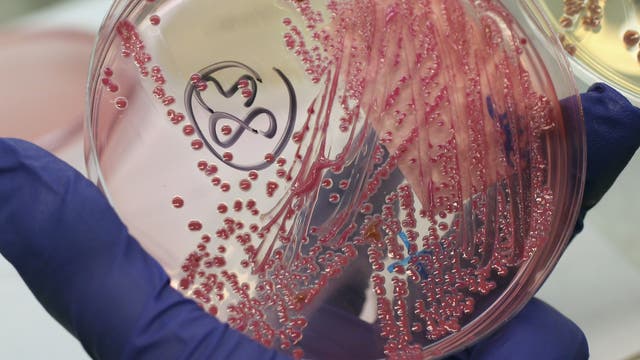 Eine Hand in einem blauen Handschuh hält eine Petrischale mit einer EHEC-Bakterienkultur. Im Hintergrund sieht man in Unschärfe einen typischen Laborhintergrund.