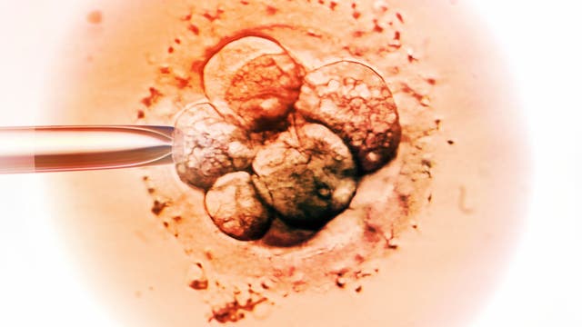 Mikroskopische Aufnahme eines Embryos im frühen Zellstadium. Eine feine Glaspipette ist links im Bild zu sehen, die möglicherweise für eine In-vitro-Fertilisation oder Zellmanipulation verwendet wird. Die Zellen sind kugelförmig und eng beieinander angeordnet, umgeben von einer transparenten Membran. Die Struktur und Anordnung der Zellen sind deutlich erkennbar.