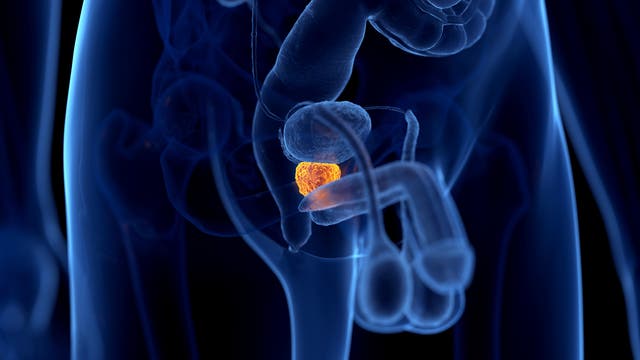 Schematische Darstellung der Prostata im Unterleib eines Mannes.