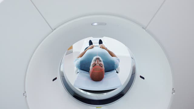 Eine Person liegt auf dem Rücken in einem CT-Scanner. Der Kopf ist in der Mitte des Scanners positioniert, und rote Laserlinien sind auf dem Kopf sichtbar, um die Ausrichtung zu gewährleisten. Die Umgebung ist klinisch und modern gestaltet.