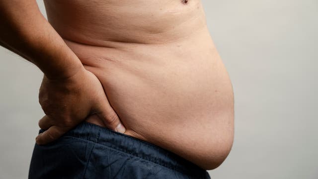 Eine Person steht seitlich und hält eine Hand in die Hüfte. Der Fokus liegt auf dem Bauchbereich. Die Person trägt eine dunkle Hose. Der Hintergrund ist neutral und hell.