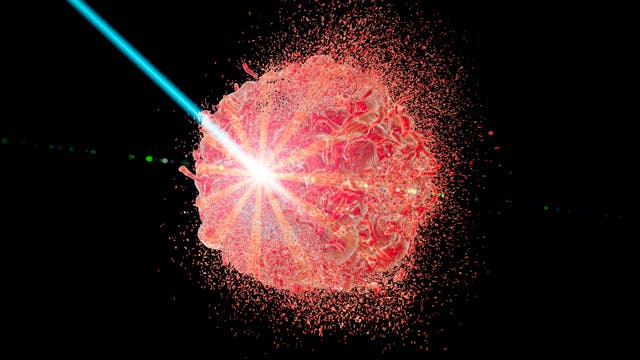 Eine 3-D-Darstellung zeigt einen roten, kugelförmigen Tumor, der von einem blauen Laserstrahl getroffen wird. Der Laserstrahl trifft den Körper von links und erzeugt eine Explosion von Partikeln, die sich radial ausbreiten. Der Hintergrund ist schwarz, was den Kontrast zur leuchtenden Explosion verstärkt.