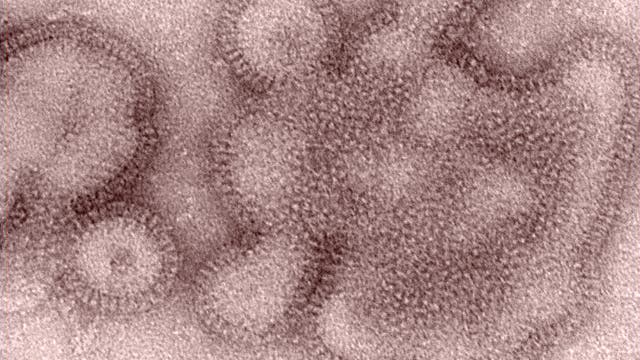 H3N2 Grippeviren
