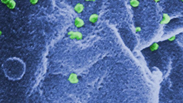 HI-Viren knospen aus einer T-Zelle