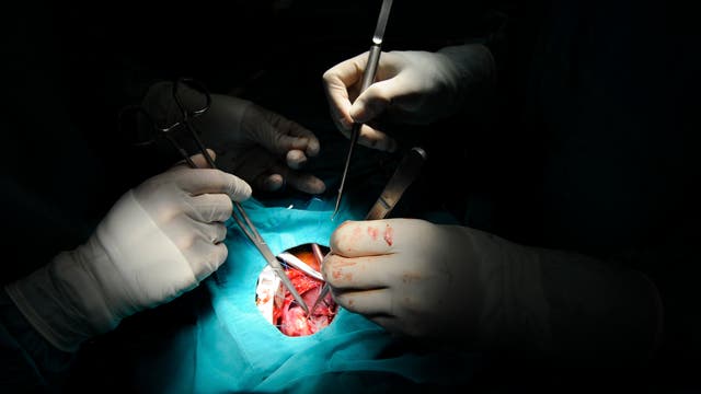 Operation am Herzen