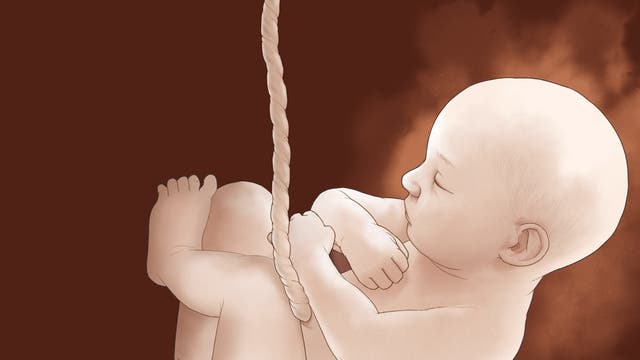 Ein gezeichneter Embryo schwimmt an seiner Nabelschnur vor braunem Hintergrund.