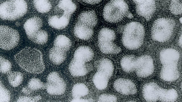 Vogelgrippe: H5N1-Viren