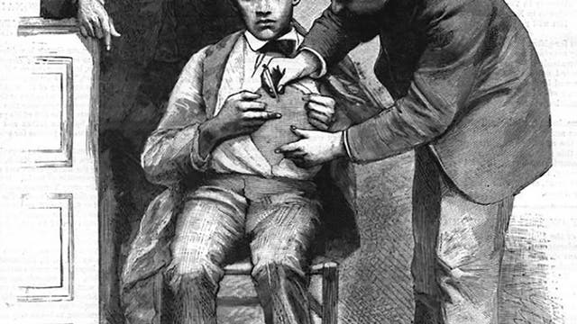 Louis Pasteur beobachtet Tollwutimpfung