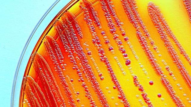 Escherichia coli wuchert in einer Petrischale
