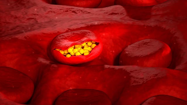 Malaria in Blutkörperchen