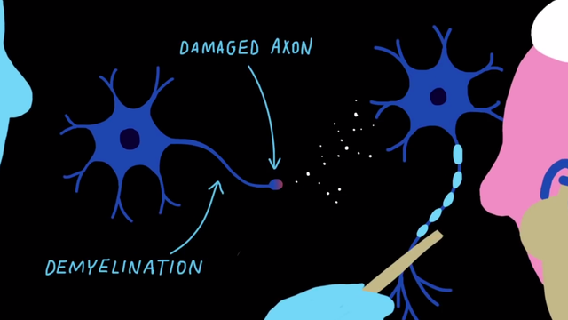 Forscher verfolgen drei Strategien, um Nervenzellen zur Regeneration anzuregen.