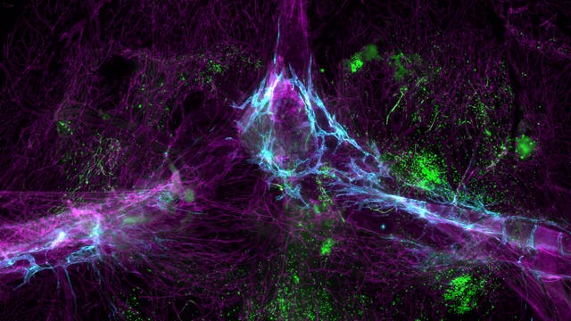 Netzwerk des neuronalen Immunsystems