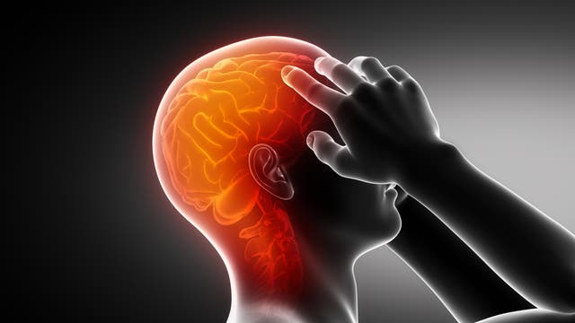 Migräne geht mit starken Kopfschmerzen einher