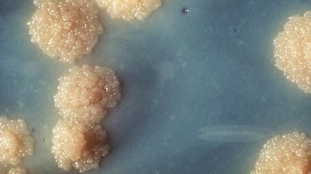 Kolonien von Tuberkulosebakterien