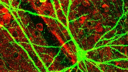 Neuronen und GABA-Interneuronen