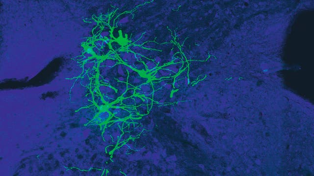 Das Bild zeigt den lateralen vestibulären Nukleus im Hirnstamm einer Maus. Die grün leuchtenden Neurone sind mit einem gentechnisch veränderten Tollwutvirus infiziert. 