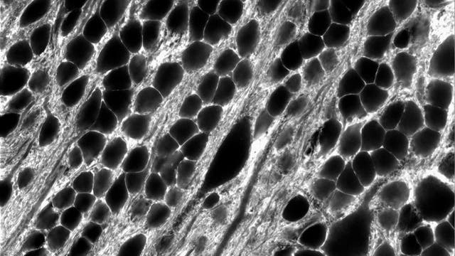 Eine neue Technik erlaubt es, lebendes Hirn­gewebe im Detail darzustellen. Die Neurone zeichnen sich hierbei als schwarze Schatten ab.