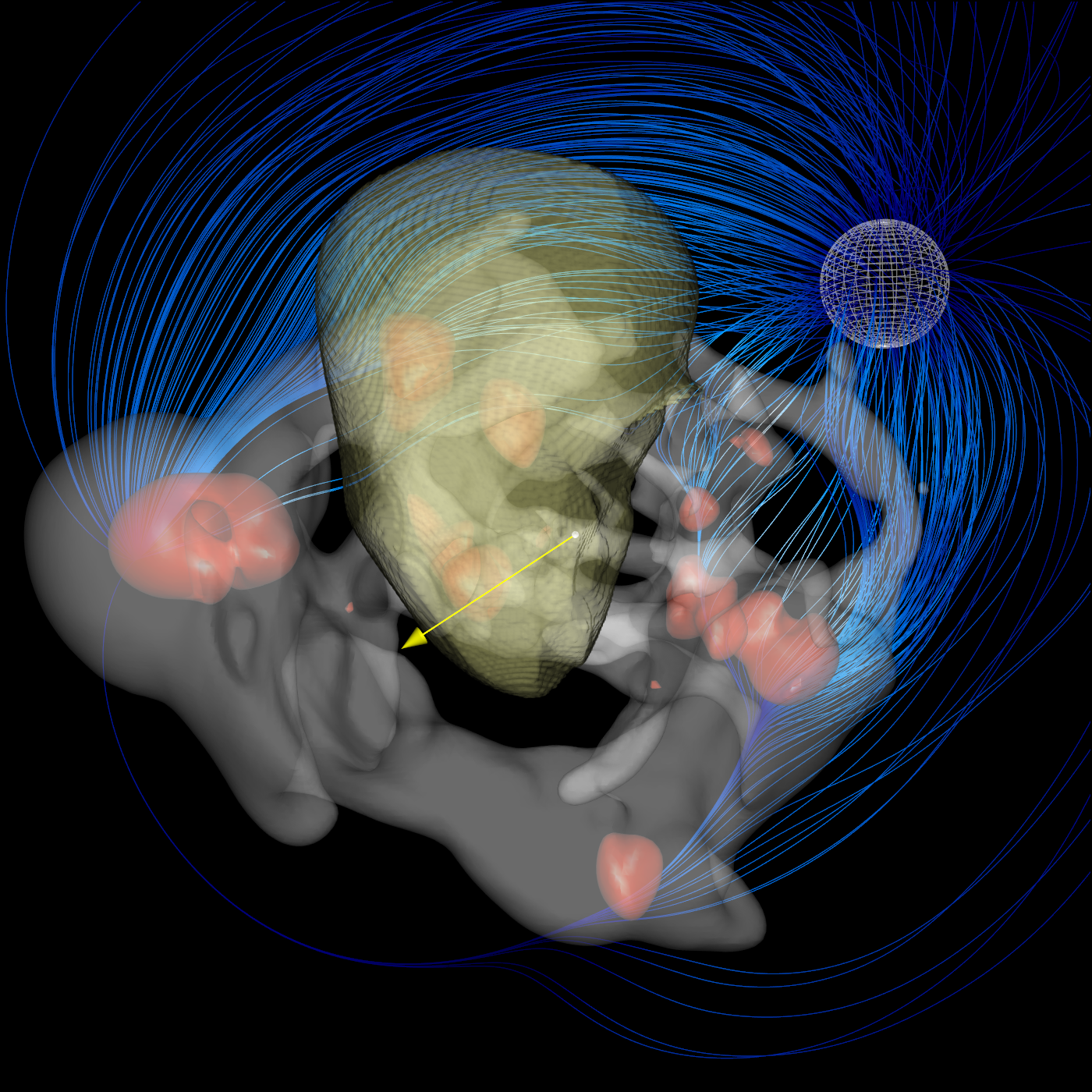 Kosmischer Dipol mit Strömungen und Laniakea (gelb)