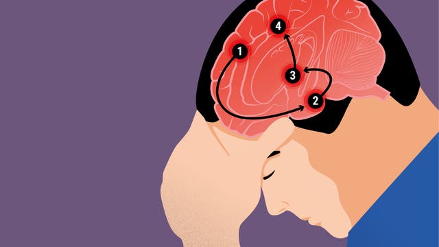 Migräne ist eine komplexe neurologische Erkrankung.