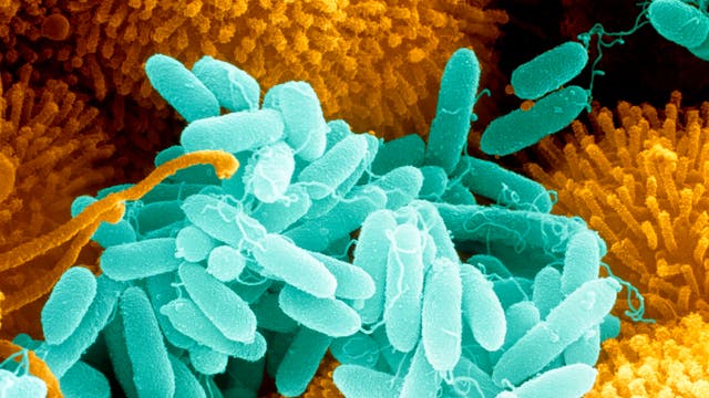 Mikroskopische Aufnahme von blau gefärbten, stäbchenförmigen Bakterien auf einer orangefarbenen, strukturierten Oberfläche. Die Bakterien sind dicht angeordnet und zeigen feine Details ihrer Zellstruktur. Die orangefarbene Oberfläche könnte eine biologische Struktur wie Gewebe oder eine Zelloberfläche darstellen.