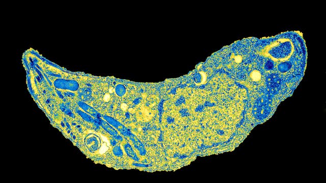 Toxoplasma gondii, 30 000-fach vergrößert