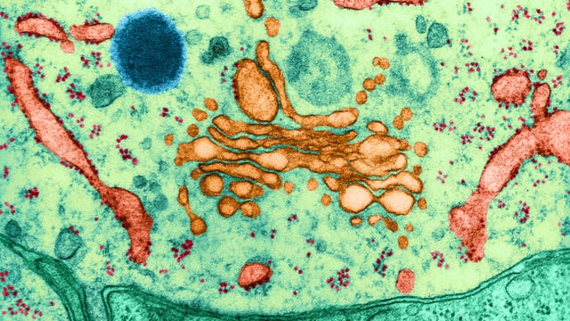 Elektronenmikroskopisches Bild einer Zelle, das verschiedene Zellstrukturen in unterschiedlichen Farben zeigt. Im Zentrum befindet sich ein komplexes, orangefarbenes Netzwerk, das den Golgi-Apparat darstellt. Umgeben ist es von blauen und grünen Bereichen, die Mitochondrien und andere Organellen darstellen könnten. Kleine rote Punkte sind gleichmäßig verteilt und könnten Ribosomen darstellen. Der Hintergrund ist hellgrün, was den zellulären Kontext hervorhebt. Das Bild veranschaulicht die komplexe Struktur und Organisation innerhalb einer Zelle.