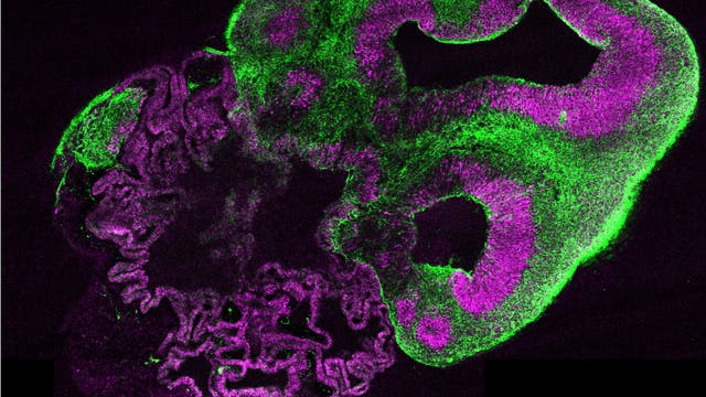Solche wenige Millimeter großen Gehirnorganoide (hier ein Schnittpräparat) entstehen aus menschlichen pluri- potenten Stammzellen – mit Strukturen, die denen beim Fötus gleichen. Die Farben markieren verschiedene Zellsorten und Hirnbereiche, rechts etwa erkennt man Strukturen einer Großhirnrinde. Neuronale Vorläuferzellen sind rot, Neurone grün.