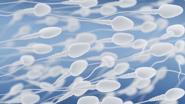 Illustration von Spermien bei der Kollektivbewegung