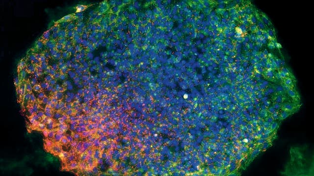 induzierte pluripotente Stammzellen